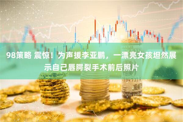 98策略 震惊！为声援李亚鹏，一漂亮女孩坦然展示自己唇腭裂手术前后照片